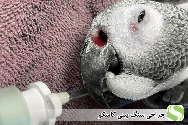 جراحی سنگ بینی کاسکو - اندیشه سبز