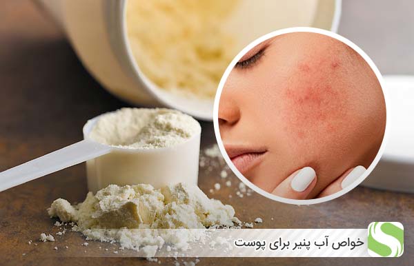 خواص آب پنیر برای پوست - اندیشه سبز